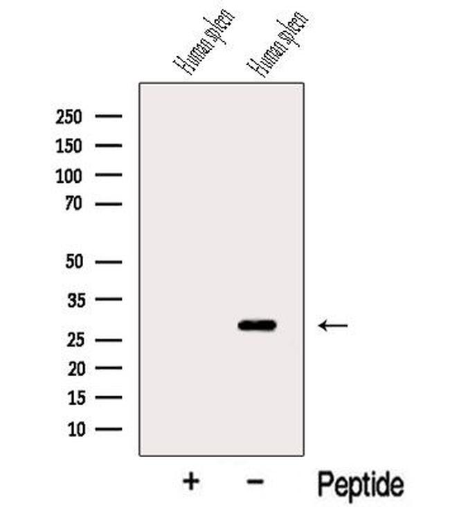 TIMM21 Antibody in Western Blot (WB)