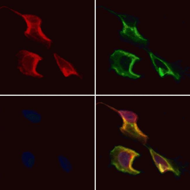 CCDC120 Antibody in Immunocytochemistry (ICC/IF)