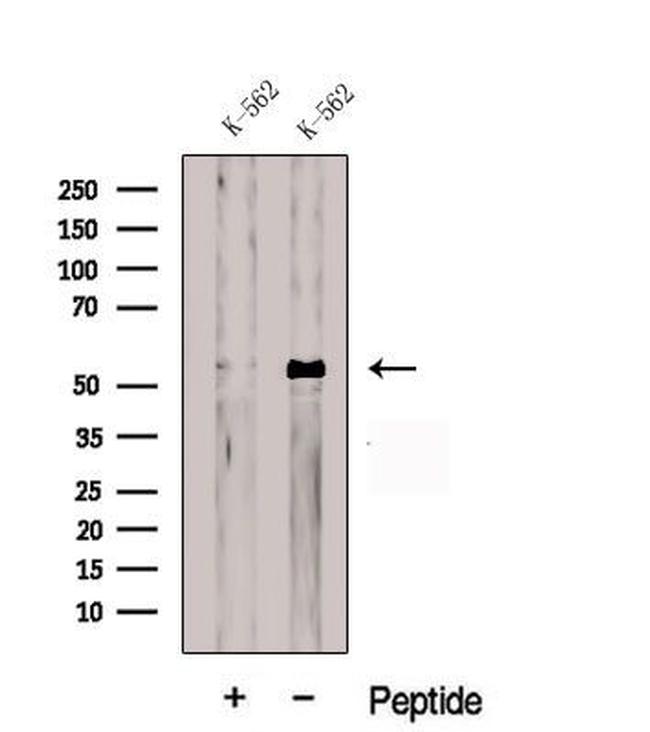 CDR2L Antibody in Western Blot (WB)