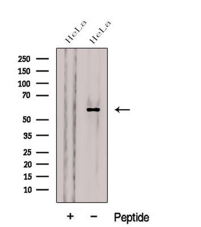 CES3 Antibody in Western Blot (WB)
