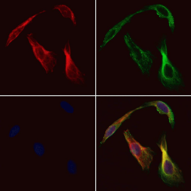 CHDH Antibody in Immunocytochemistry (ICC/IF)