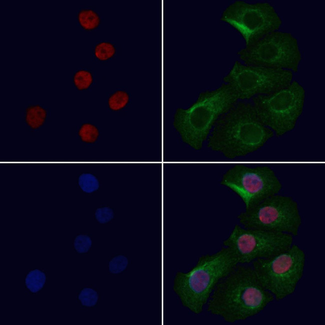 COMMD5 Antibody in Immunocytochemistry (ICC/IF)