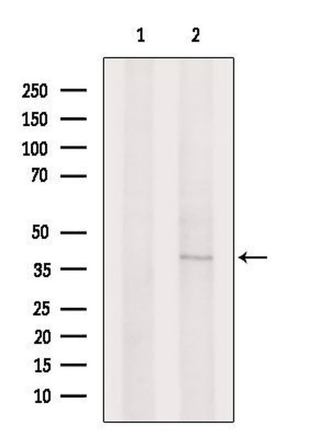 DCUN1D5 Antibody in Western Blot (WB)