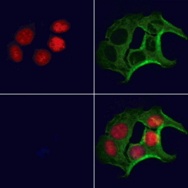 Folliculin Antibody in Immunocytochemistry (ICC/IF)