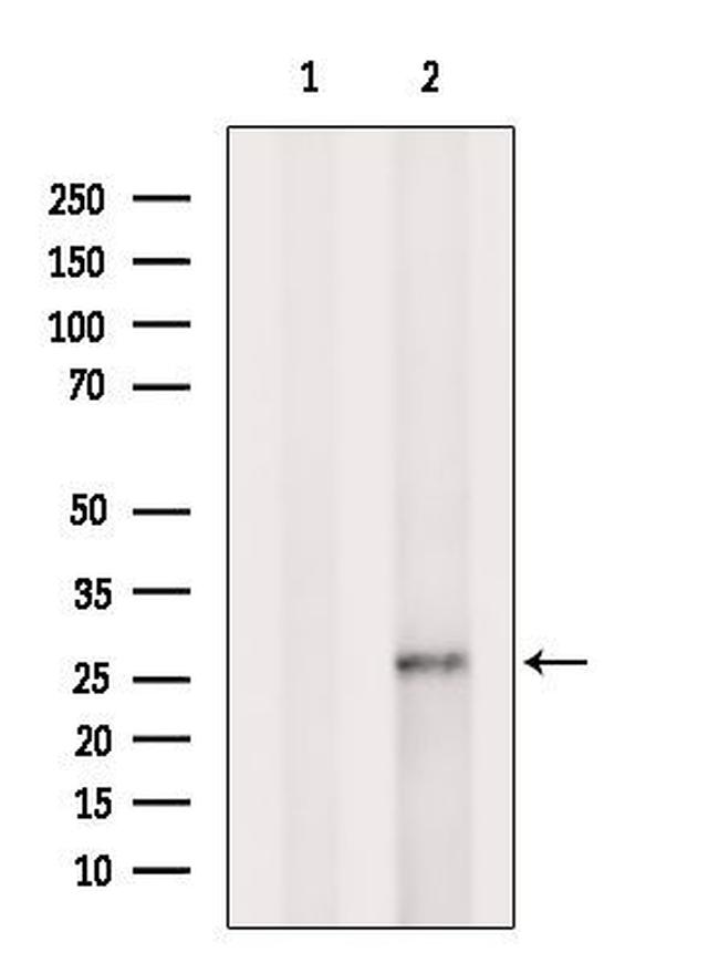 GSTA2 Antibody in Western Blot (WB)