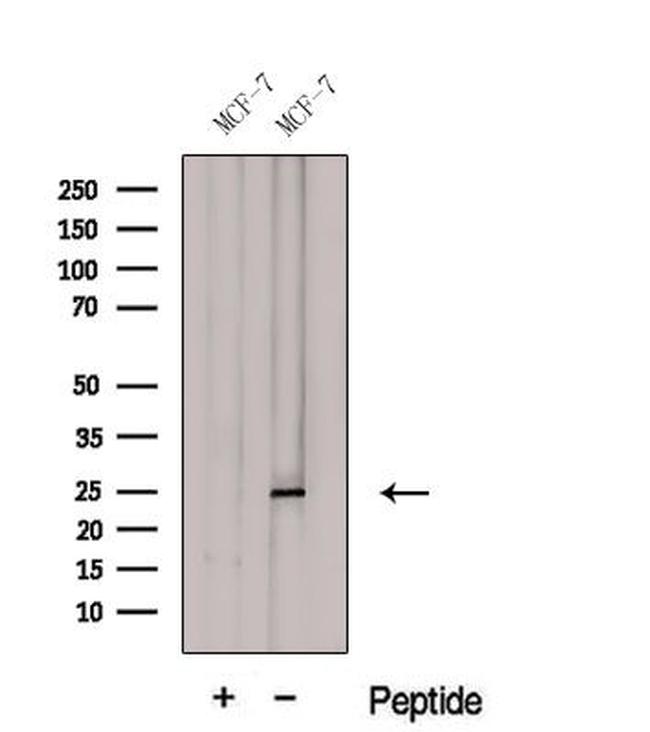 GSTA3 Antibody in Western Blot (WB)