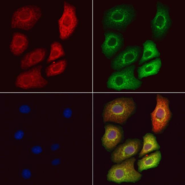 GSTT2B Antibody in Immunocytochemistry (ICC/IF)