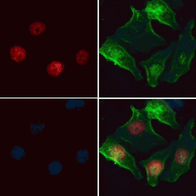 HELLS Antibody in Immunocytochemistry (ICC/IF)