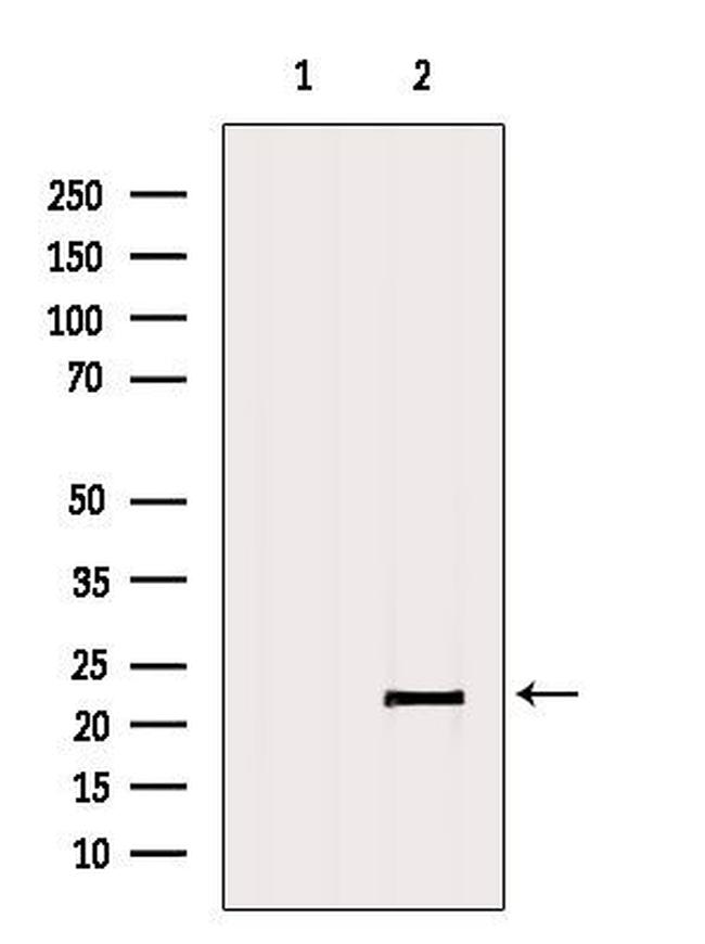 C11orf73 Antibody in Western Blot (WB)