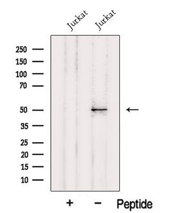 HMG20A Antibody in Western Blot (WB)