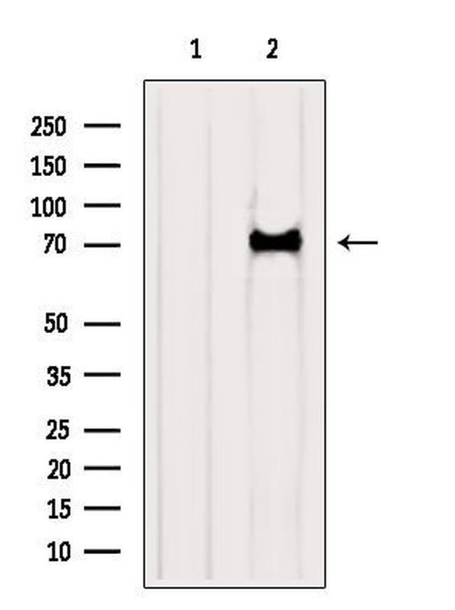Katanin p80 Antibody in Western Blot (WB)