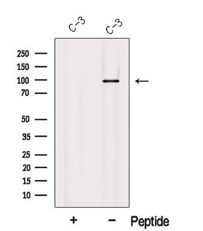 USHBP1 Antibody in Western Blot (WB)
