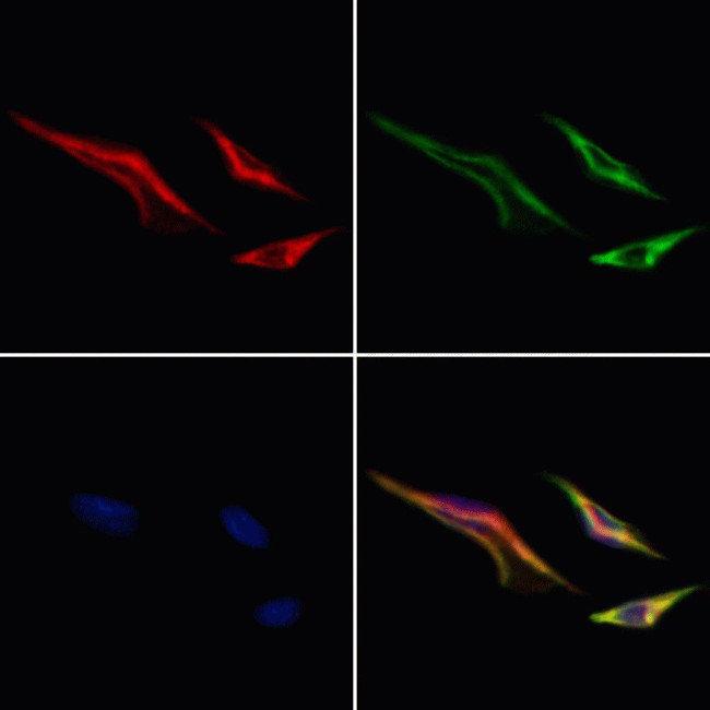 MTCH2 Antibody in Immunocytochemistry (ICC/IF)
