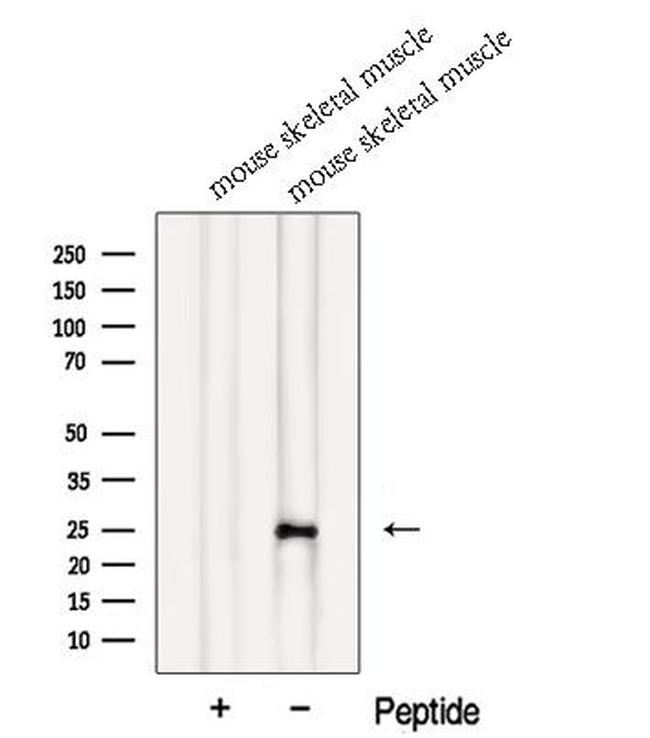 MXD1 Antibody in Western Blot (WB)