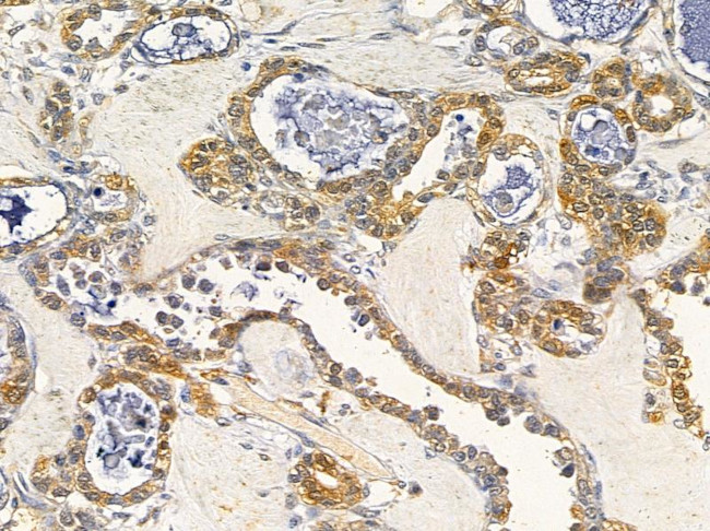 NCS1 Antibody in Immunohistochemistry (Paraffin) (IHC (P))