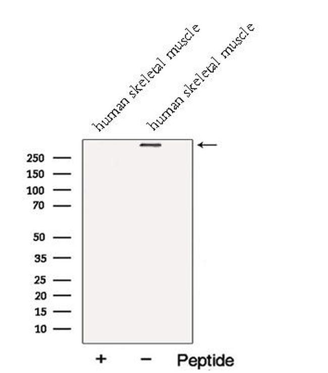 Nebulin Antibody in Western Blot (WB)