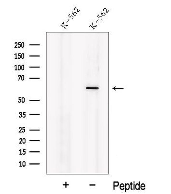 NOSTRIN Antibody in Western Blot (WB)