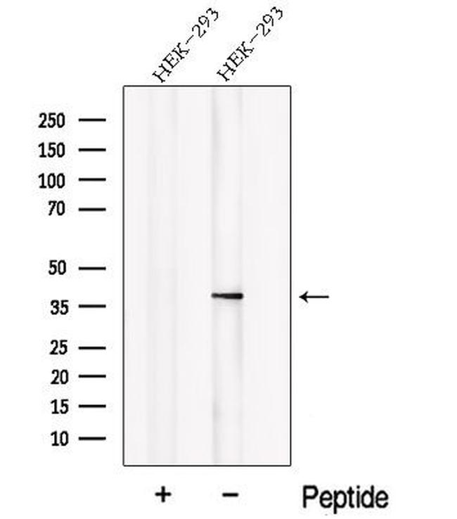 NSFL1C Antibody in Western Blot (WB)