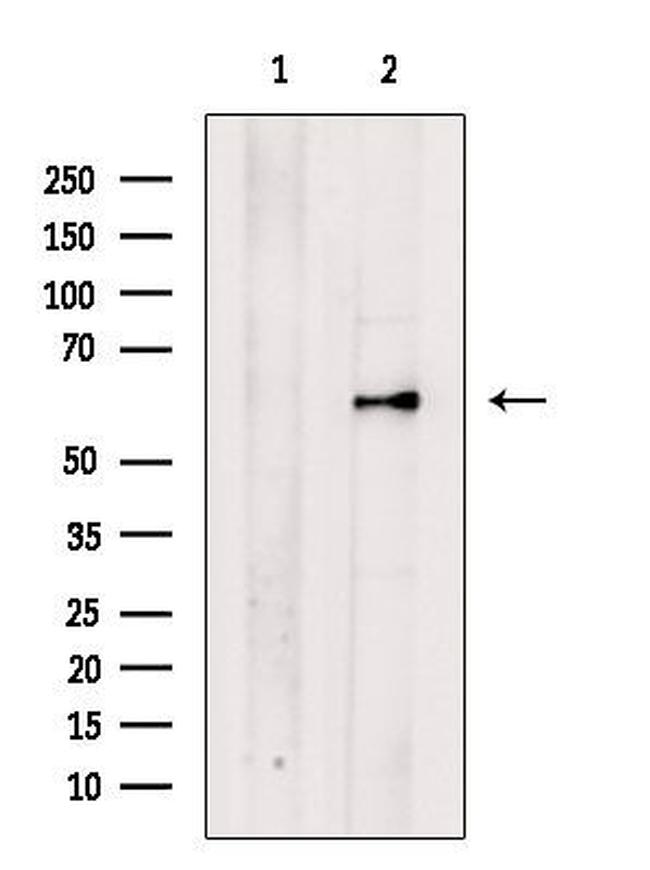 PALMD Antibody in Western Blot (WB)