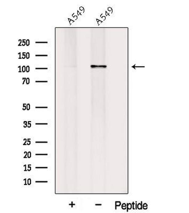 PLEKHG5 Antibody in Western Blot (WB)