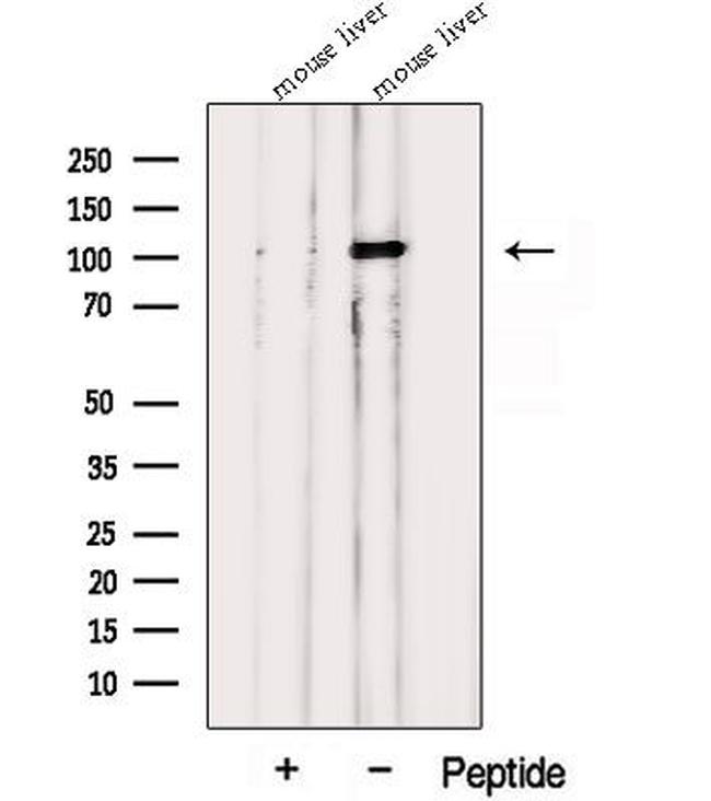 PPARGC1B Antibody in Western Blot (WB)
