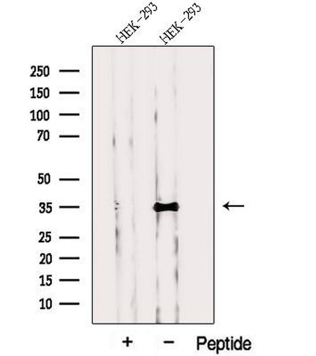 PP1 gamma Antibody in Western Blot (WB)