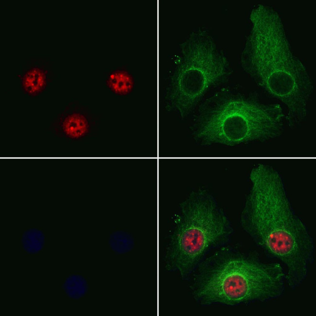 PRPF4 Antibody in Immunocytochemistry (ICC/IF)