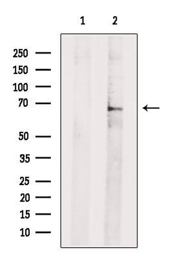 RHOT2 Antibody in Western Blot (WB)
