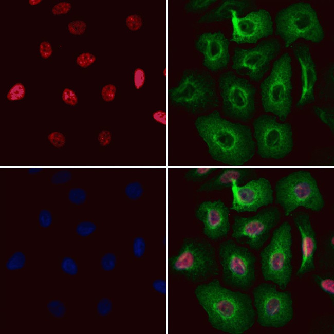 RNaseH2C Antibody in Immunocytochemistry (ICC/IF)