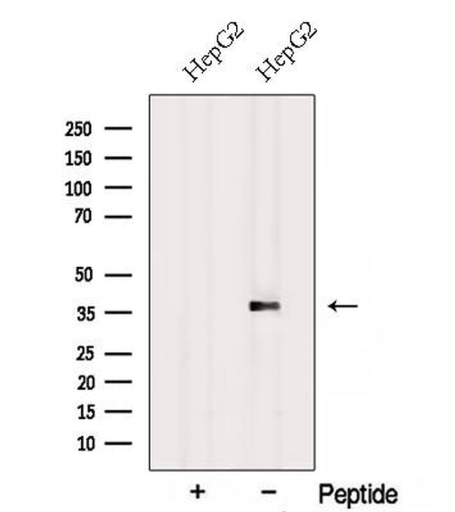 RPH3AL Antibody in Western Blot (WB)