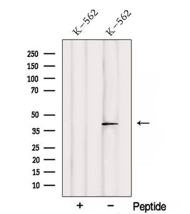 SAMSN1 Antibody in Western Blot (WB)