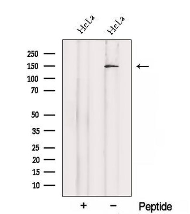 SETBP1 Antibody in Western Blot (WB)