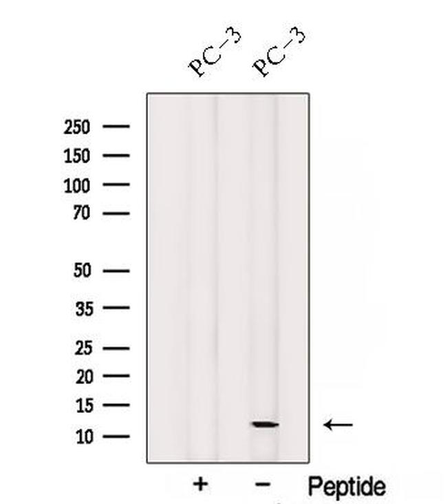 SPCS1 Antibody in Western Blot (WB)