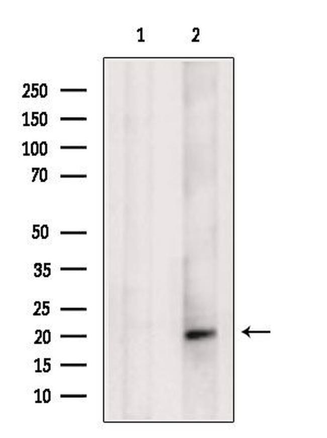 SRP19 Antibody in Western Blot (WB)
