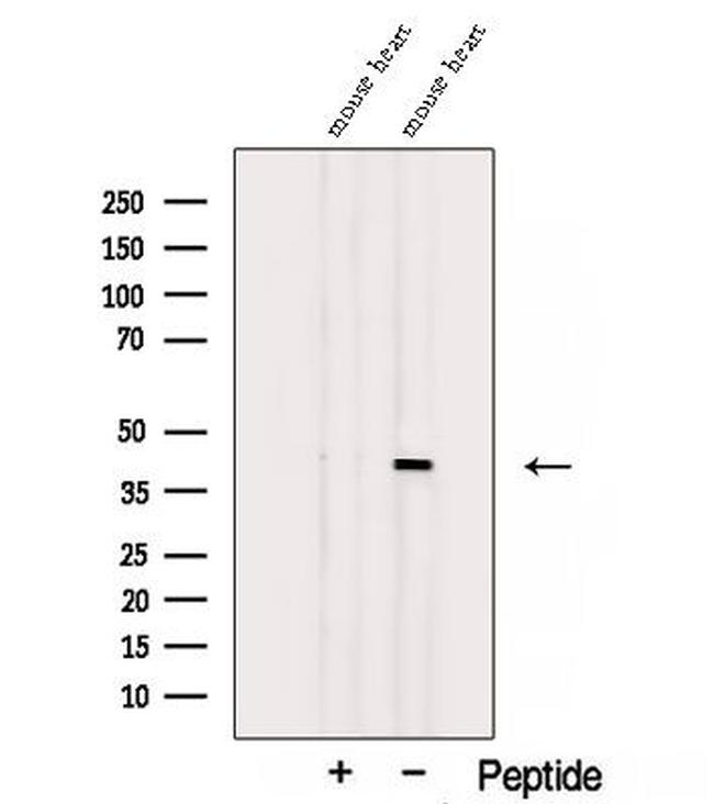 ST8SIA2 Antibody in Western Blot (WB)