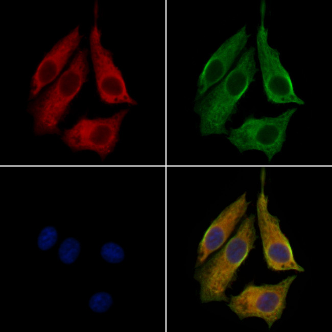 STX7 Antibody in Immunocytochemistry (ICC/IF)