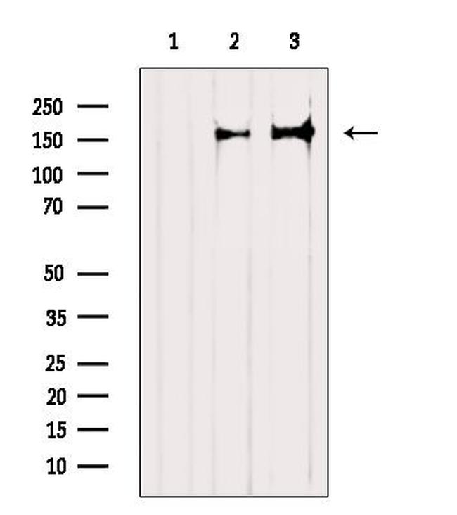 TALPID3 Antibody in Western Blot (WB)