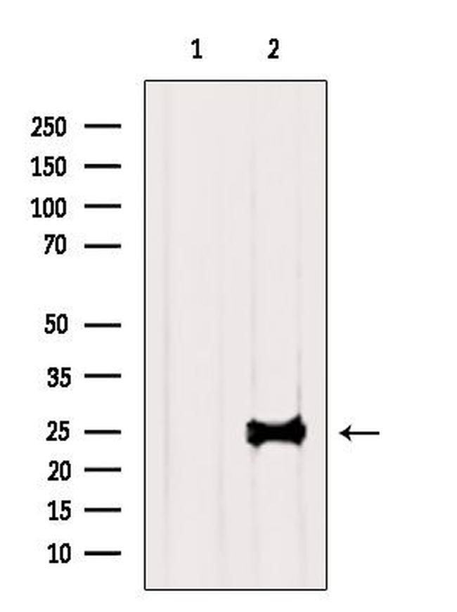 TESC Antibody in Western Blot (WB)