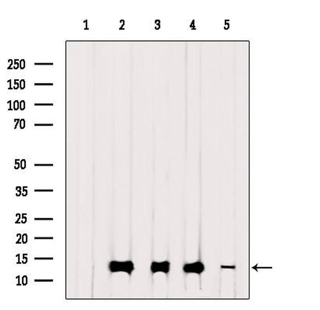 TIMM13 Antibody in Western Blot (WB)