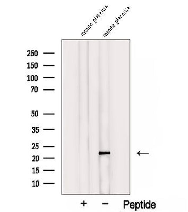 TMEM11 Antibody in Western Blot (WB)