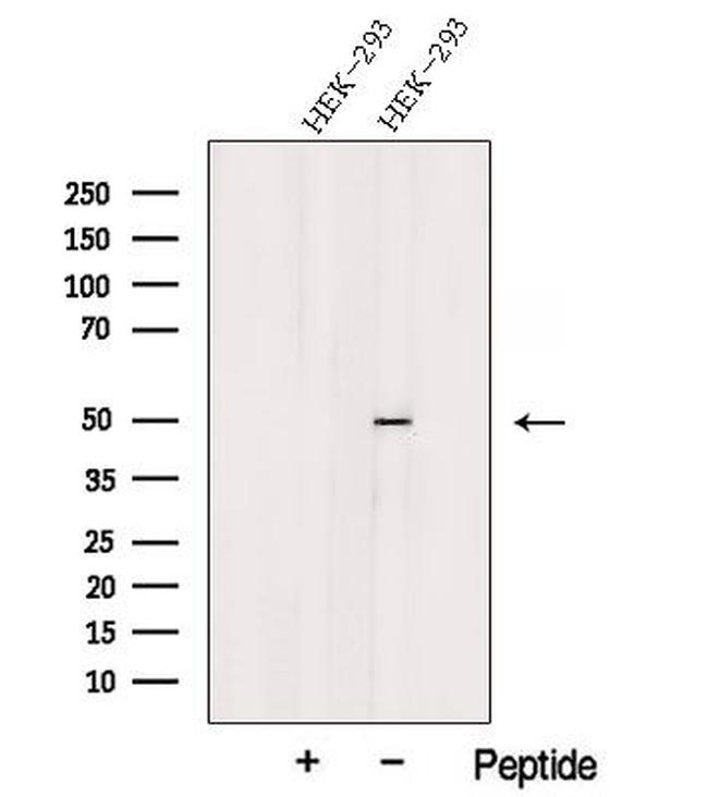 TSP50 Antibody in Western Blot (WB)