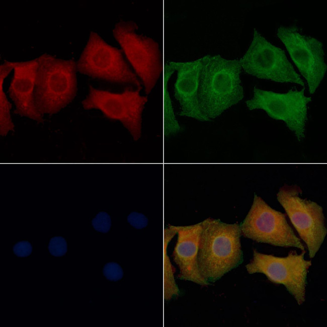 Alcohol Dehydrogenase 1B Antibody in Immunocytochemistry (ICC/IF)