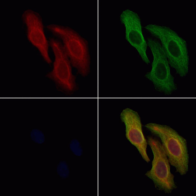AFAP1L2 Antibody in Immunocytochemistry (ICC/IF)