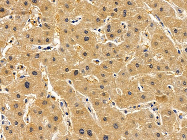 ARD1A Antibody in Immunohistochemistry (Paraffin) (IHC (P))