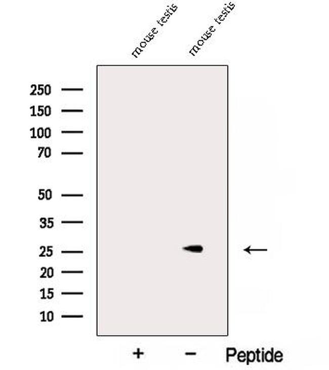 NAA11 Antibody in Western Blot (WB)