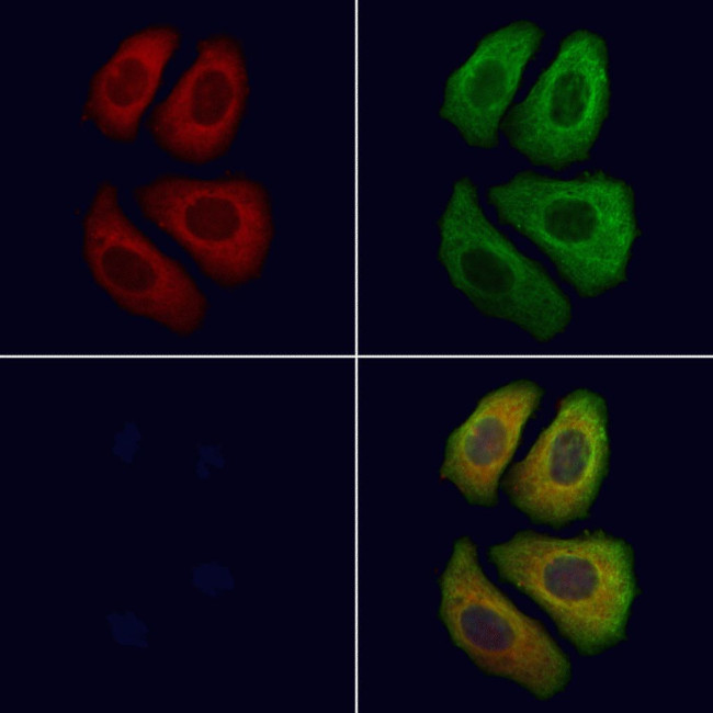 ARHGAP15 Antibody in Immunocytochemistry (ICC/IF)