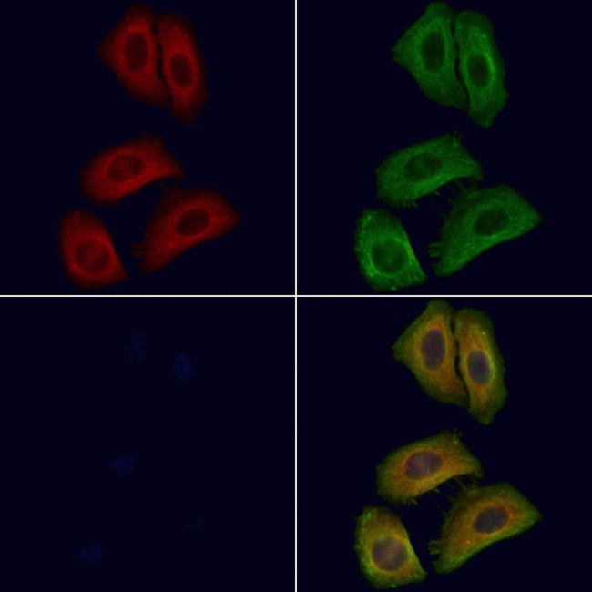 ARL7 Antibody in Immunocytochemistry (ICC/IF)
