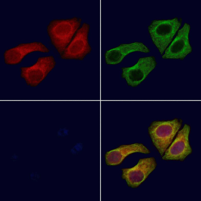 ARL5B Antibody in Immunocytochemistry (ICC/IF)