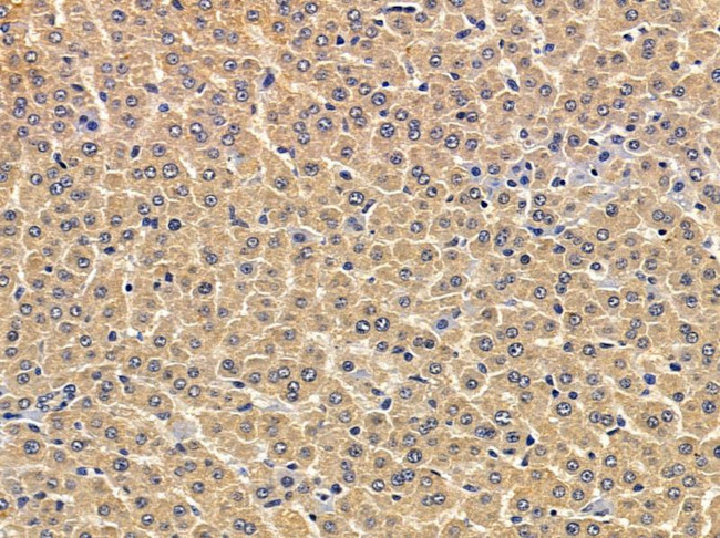ATL3 Antibody in Immunohistochemistry (Paraffin) (IHC (P))