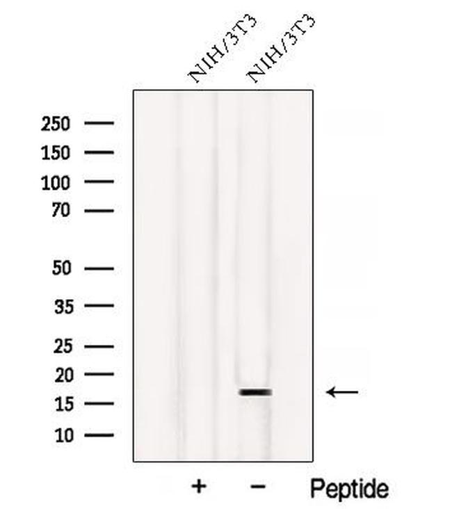 ATP5D Antibody in Western Blot (WB)